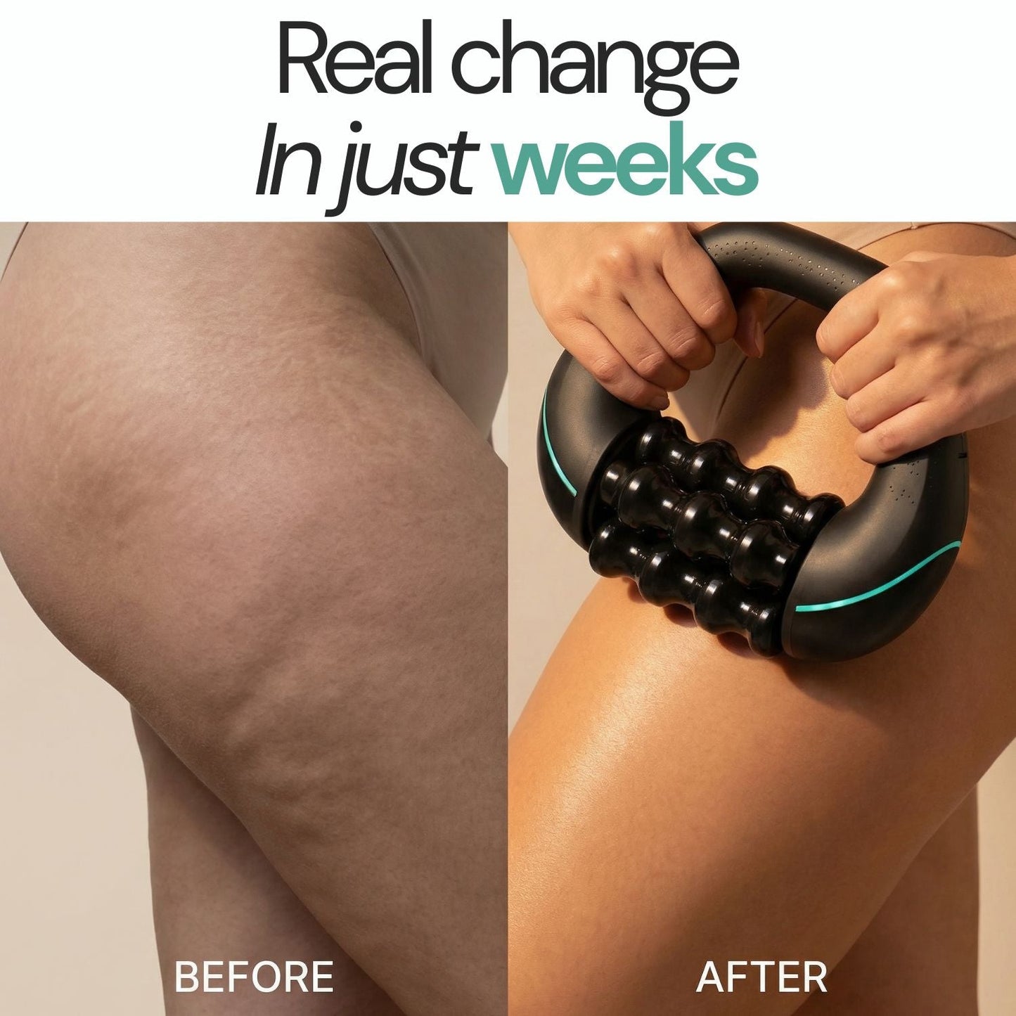 Quenzly® Rollshaper